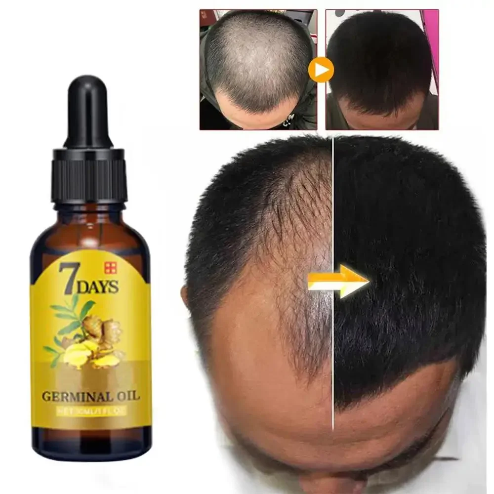 Hair Care Essence Oil Spray - Hair Growth Ginger Fast Growing Hair