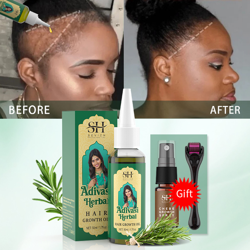 Ayurvedic Hair Growth Oil Indi - Hair Care Essence Oil Spray 评论和价格