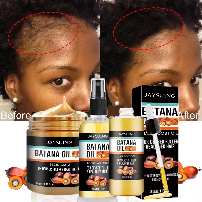 Batana Oil Thick Hair Serum Sp - Hair Care Essence Oil Spray 评论和价格