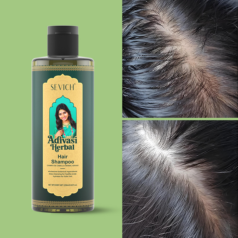 SEVICH Herbal Hair Growth Oil  - Hair Care India 评论和价格