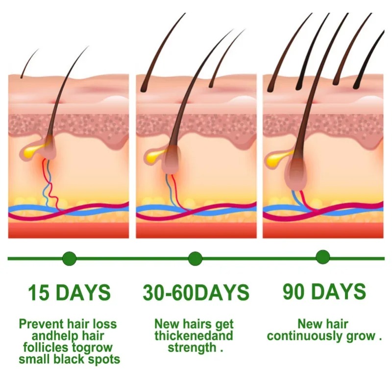 Hair Growth Serum Fast Growing - Hair Care Essence Oil Spray 评论和价格