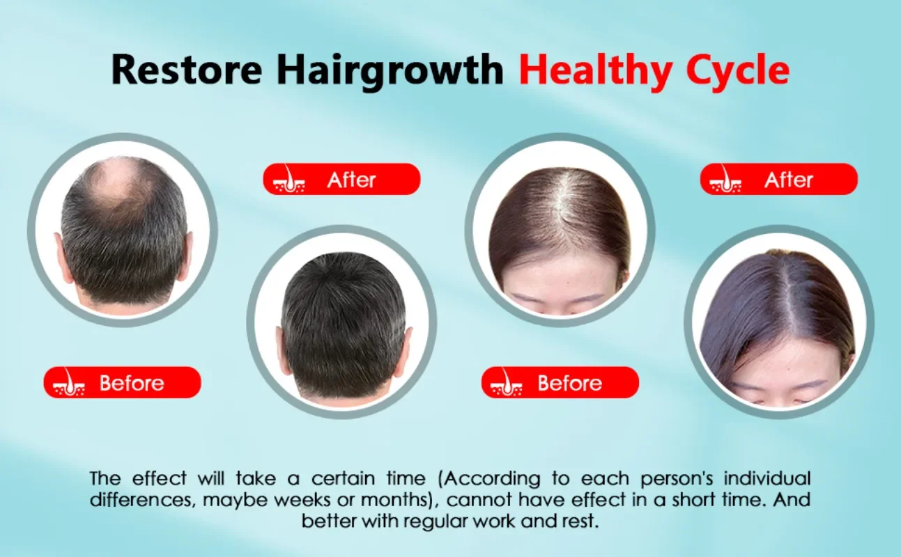Hair Growth Cap Rechargeable 2 - Hair Care Vegan 评论和价格