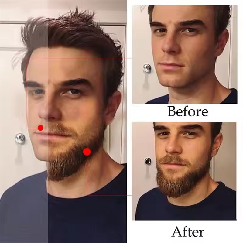 Fast Natural Mature Men Beard  - Hair Care Essence Oil Spray 评论和价格