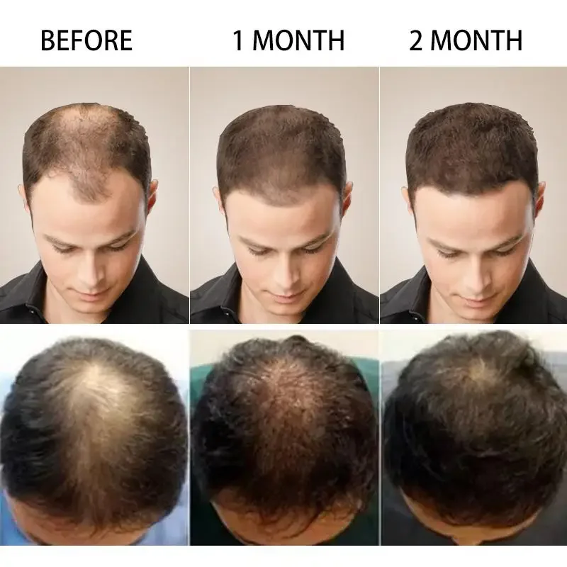 Hair Growth Ginger Fast Growin - Hair Care Essence Oil Spray 评论和价格